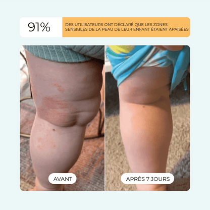 DermEau - Filtre de bain - DermEau