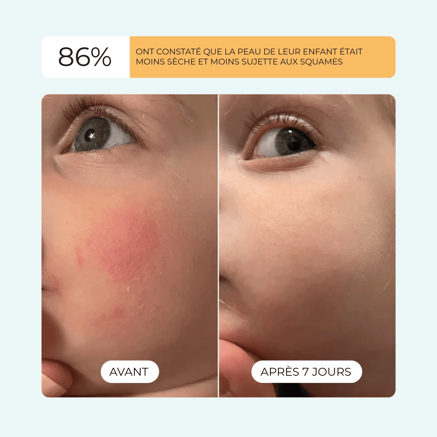 DermEau - Filtre de bain - DermEau